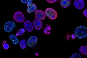 link to library blog - Apoptosis of Breast Cancer Cells