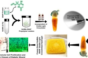 link to library blog - Ruthenium Photocrosslinking with GelMA