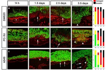 link to library blog - Migration of Cancer Cells