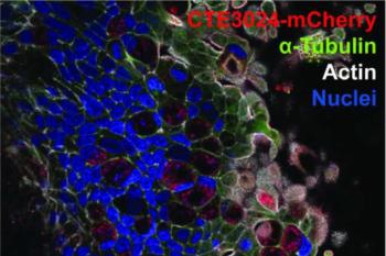 link to library blog - Fallopian Tube Cell Culture Model