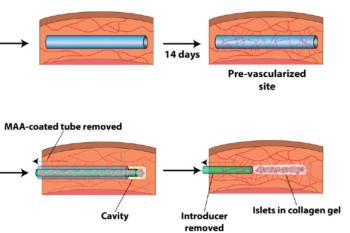 link to library blog - Biomaterial for Islet Transplantation