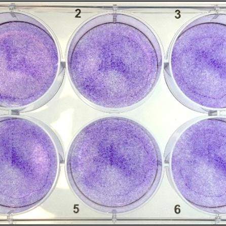 Human Fibroblasts in a CytoSoft™ 6-Well Plate