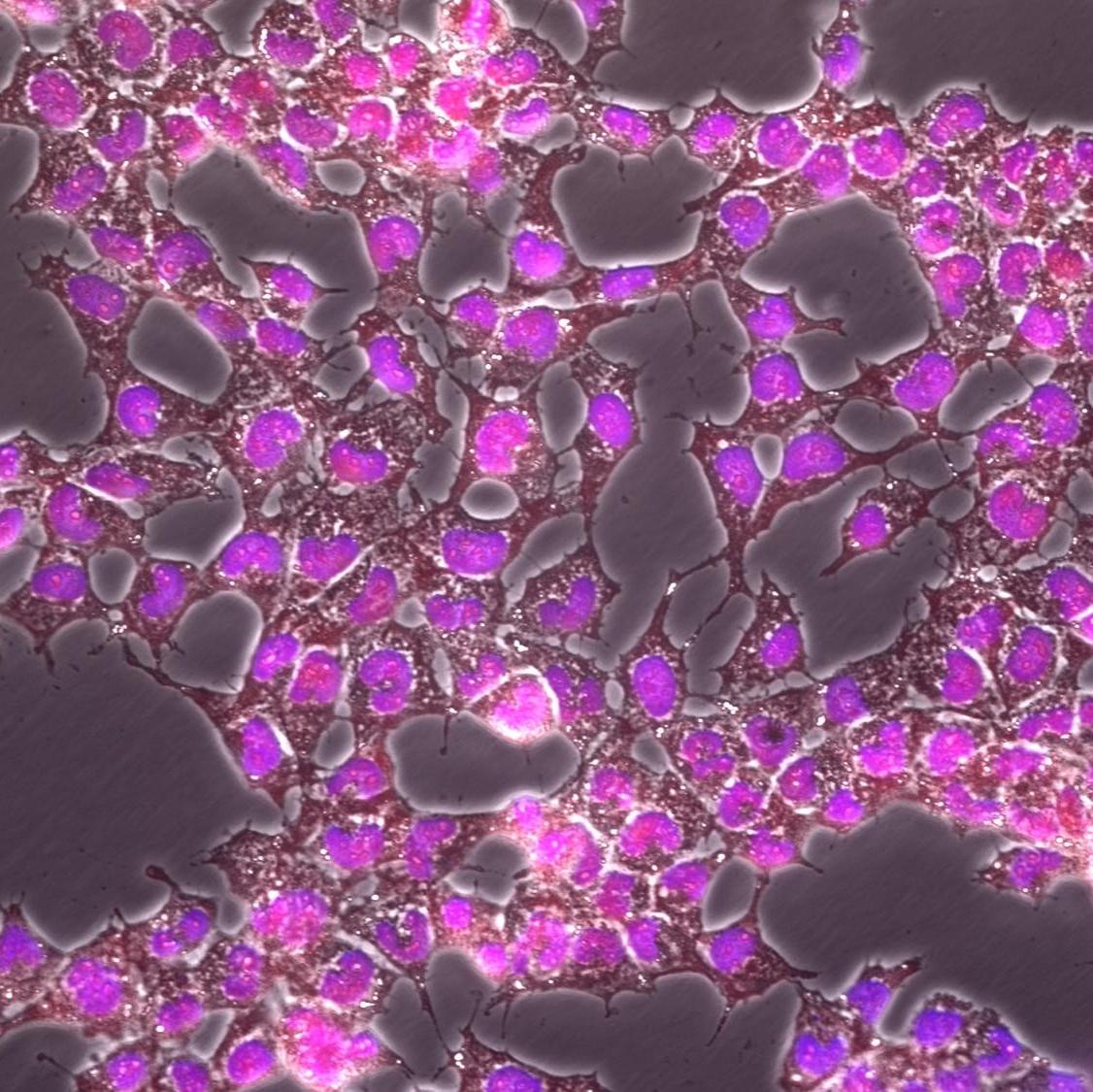 Overlay of MCF-7 Cells Stained with Cytus™ Red and Cytus™ Blue