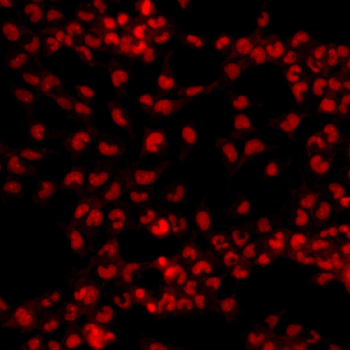 Nonviable MCF-7 Cells Stained with Cytus™ Red