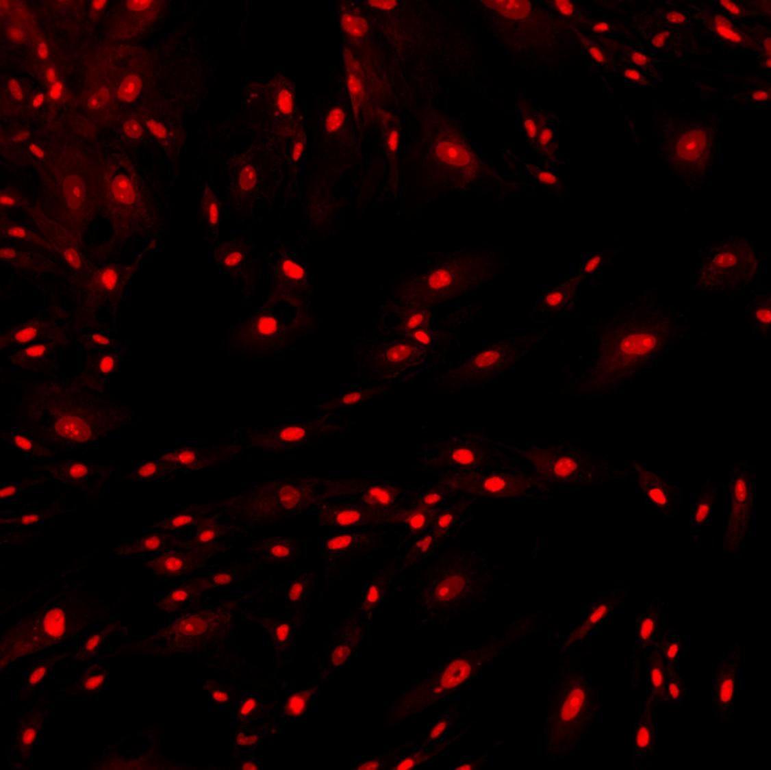 Nonviable Fibroblasts Stained with Cytus™ Red