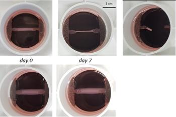 link to library blog - PureCol EZ Gel Bioartificial Tendons