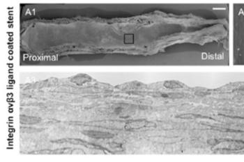 link to library blog - Pro-Healing Stent