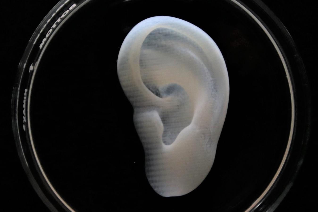 3D bioprinted collagen ear