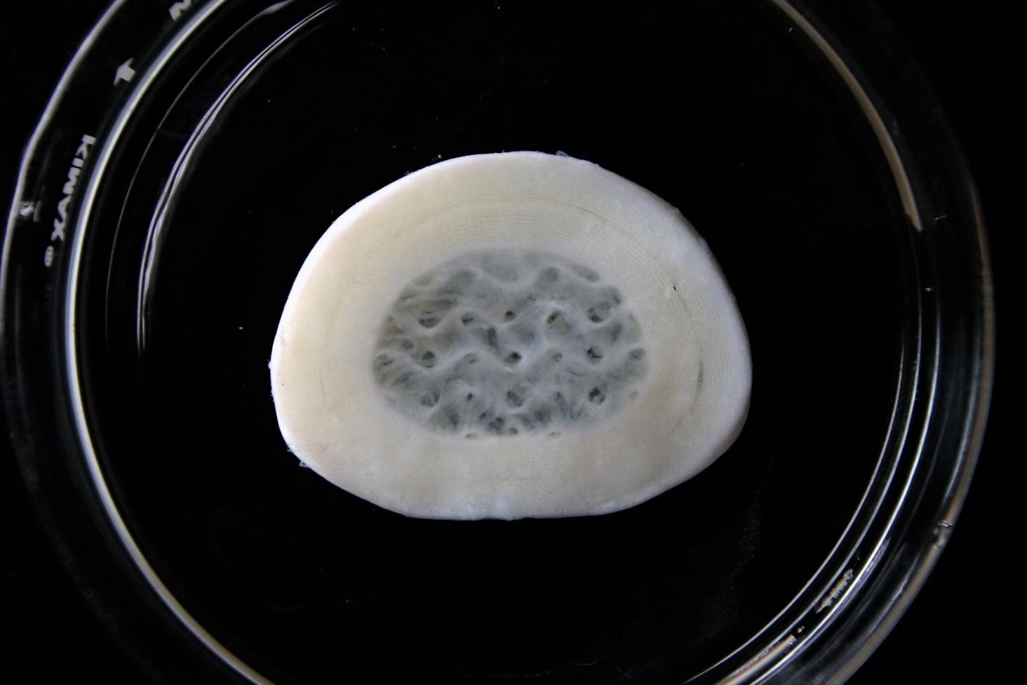 3D bioprinted intervertebral disc