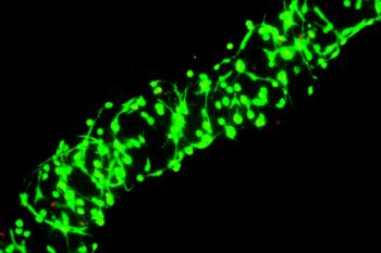 link to library blog - Fibroblasts in Lifeink 200