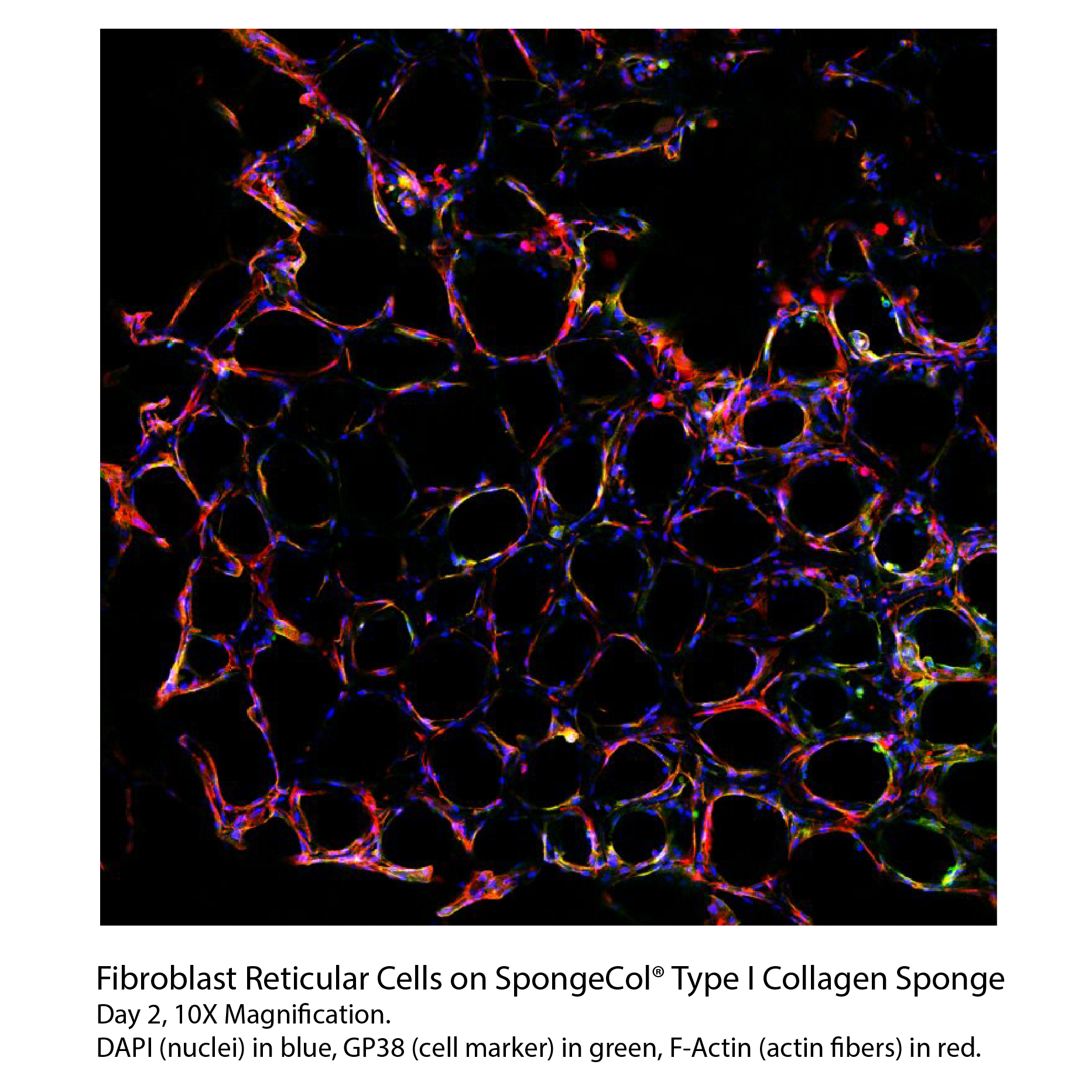 spongecol reticular cells day 2