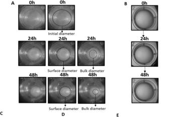 link to library blog - Collagen to Study Lens Dislocation
