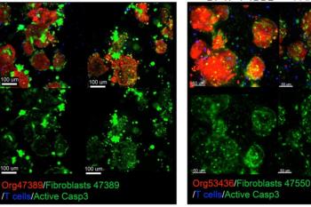 link to library blog - T Cell Killing of Tumor Cells