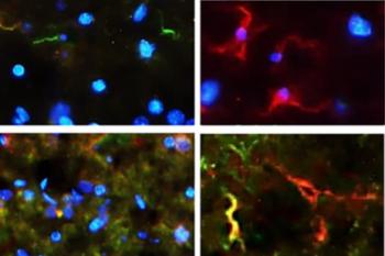 link to library blog - Stem Cells in HyStem for Spinal Cord Regeneration