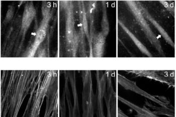 link to library blog - PhotoCol and Glycosil Tunable Hydrogels
