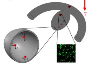 link to library blog - Cerebral Aneurysm Models