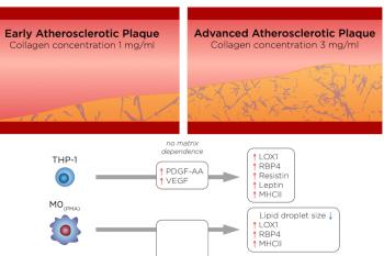 link to library blog - Biomimetic 3D Models - Atherosclerosis