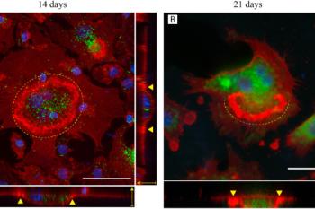 link to library blog - PureCol for Human Osteoclast Formation