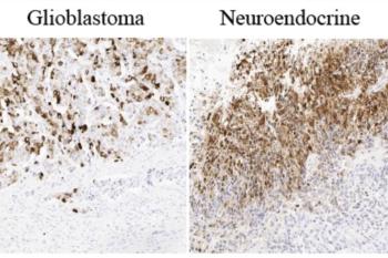 link to library blog - Immunofluorescence Staining of Collagen