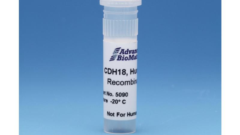 Amazon.com: CB6 Carbon Block Water Filter Replacement, 0.5