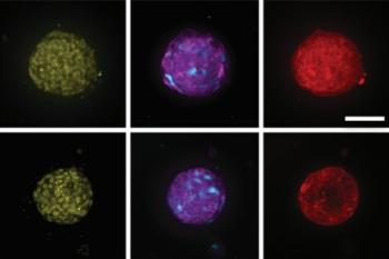 link to library blog - Actin Cytoskeleton Staining Protocol