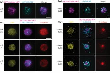 link to library blog - Collagen Stiffness Affects Spheroid Migration