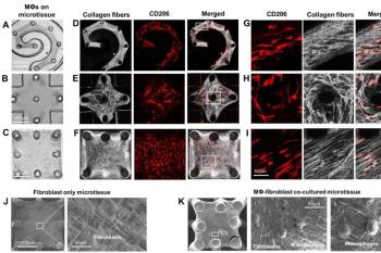 link to library blog - Fibrotic Microtissue Model