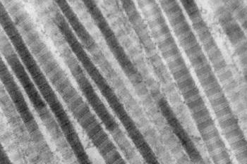 link to library blog - Collagen Fiber Diameter and Pore Size