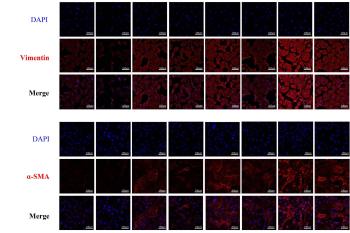 link to library blog - Studying Cardiac Fibrosis with CytoSoft