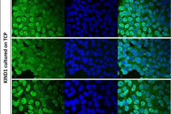 link to library blog - CytoSoft and hPSCS