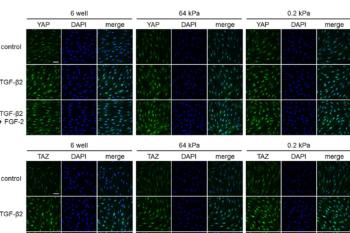 link to library blog - Activation of Fibroblast Modulated by Stiffness