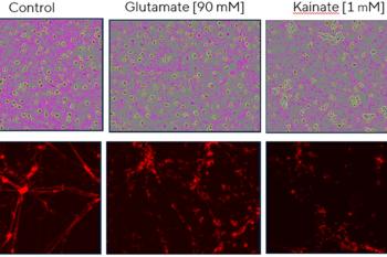 link to library blog - Matrigel Alternatives for Neuronal Assays