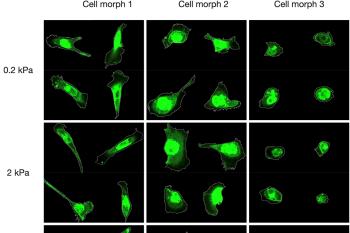 link to library blog - Matrix Stiffness Affects Breast Carcinoma