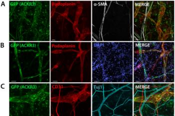 link to library blog - Evaluation of ACKR3 for Postnatal Lymphangiogenesis