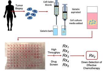 link to library blog - Bioprinting Organoids for Chemotherapy Screening
