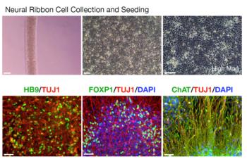 link to library blog - PureCol EZ Gel for Transplantable Neural Networks