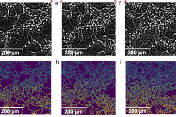 link to library blog - Brain-Derived Neuronal Cultures