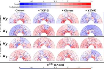 link to library blog - Cells Stiffen Localized Matrix