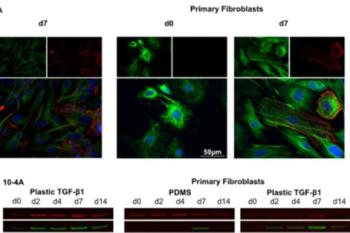 link to library blog - Rat Tail Collagen to Study Pulmonary Fibrosis