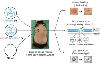 link to library blog - Collagen Hydrogel for Diabetic Wounds