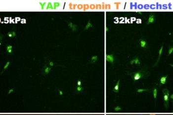 link to library blog - Substrate Stiffness to Study Cardiomyocytes