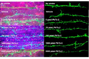 link to library blog - HyStem-HP Injection for Neural Repair