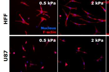 link to library blog - Stiffness effects on HFF and U87 Cell Morphology